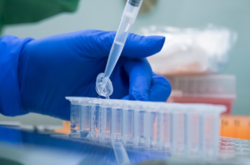 Міністерстві охорони здоров’я планує максимально широко використовувати вітчизняний ІФА-тест на антиген коронавірусу