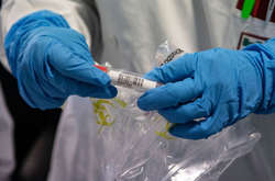 Кількість смертей від Covid-19 зросла до понад 1,9 млн осіб