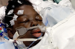 Ребенку с редким заболеванием Covid-19 пришлось ампутировать ноги