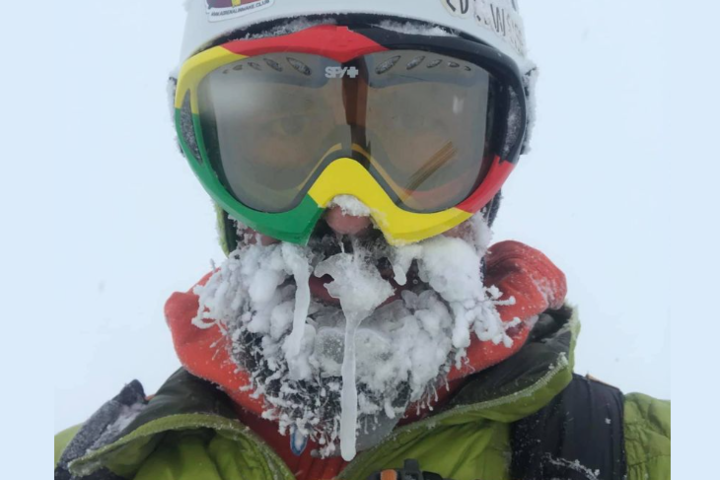Волонтер, який шукав туриста у Карпатах, показав своє «заморожене» обличчя (фото)