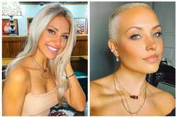 Девушка устала скрывать залысины и доказала, что она красотка и без волос (фото)