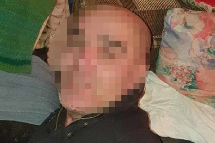 У Києві іноземець жорстоко побив свою подругу