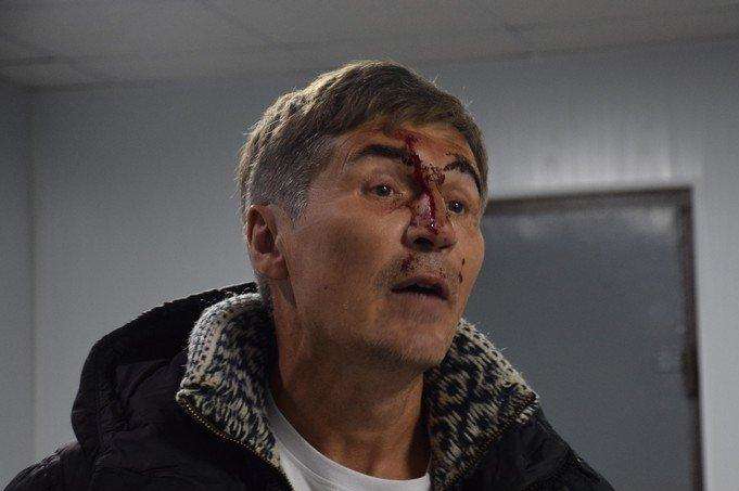 Розбили до крові обличчя та наділи наручники: у Миколаєві затримали екснардепа 