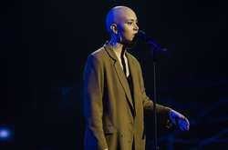 16-летняя Анастасия страдает алопецией