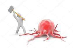 Джобс і Маккейн вмерли не в Україні. Головлікар Інституту раку спростував міф про те, що у нас погано лікують онкологію