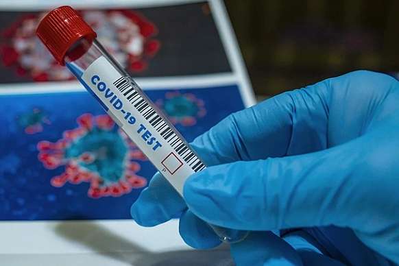 Коронавірус на Одещині: 90 нових випадків