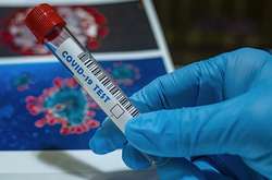 Лабораторно підтверджених випадків всього – 82539 