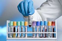  Всі, хто захоче в Україні вакцинуватися, – вакцинується, обіцяє Віктор Ляшко 