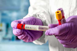 За весь час пандемії в Україні захворіло – 1 317 694 особи