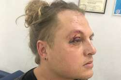 В Одесі скоєно замах на життя головного режисера Оперного театру (фото, відео)