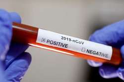 Станом на 2 березня на коронавірусну інфекцію в Одеській області захворіли всього 86418 жителів