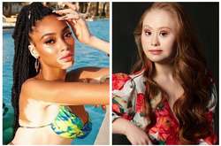 Этим девушкам удалось покорить мир несмотря на необычную внешность (фото)