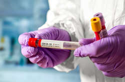 До лікарень столиці госпіталізували 148 пацієнтів