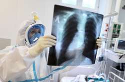 За минулу добу в Україні виявлено 15850 нових хворих на Covid-19