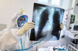 Коронавирус вызывает тяжелые пневмонии