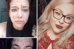 Впечатляющие трансформации людей, которые смогли побороть наркотическую зависимость