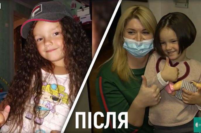 У Вінниці 5-річна дівчинка відрізала своє волосся заради допомогти онкохворому хлопчику (відео)