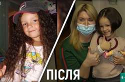 У Вінниці 5-річна дівчинка відрізала своє волосся заради допомогти онкохворому хлопчику (відео)