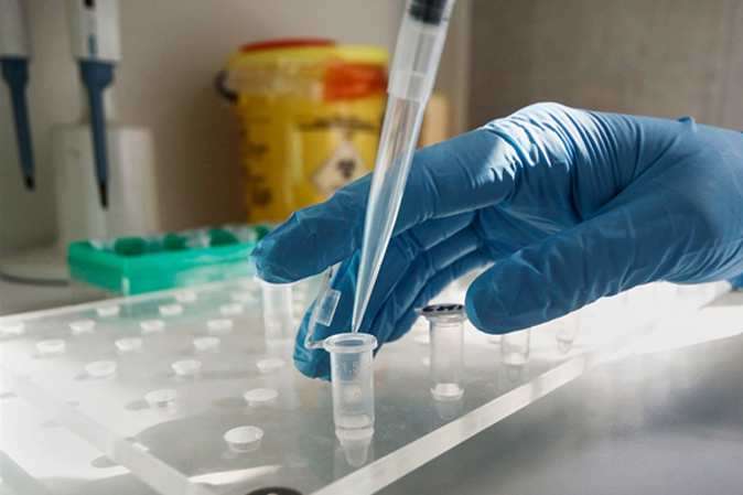Вчені виявили небезпечні особливості бразильського штаму коронавірусу