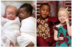 Необычные двойняшки уже подросли, и мама устроила им фотосессию