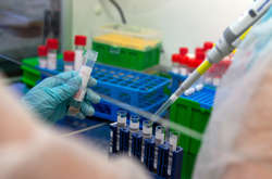 Найбільше хворих виявили в Індії, США й Туреччині