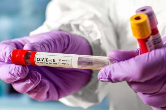 На Буковині виявили лише 62 нових випадки коронавірусу за добу