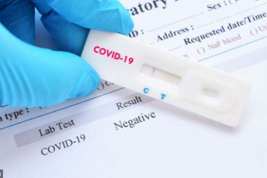 Ляшко: Тест на антитіла до Covid-19 – маркетинговий хід