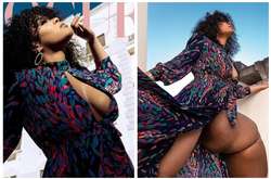 Девушка отказалась ампутировать свою гигантскую ногу и стала моделью (фото)