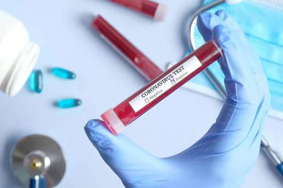 На Буковині виявили 24 нових випадків коронавірусу за добу