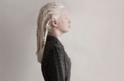 Девочку-альбиноса отдали в детдом, но спустя 16 лет красотка попала на обложку Vogue (фото)