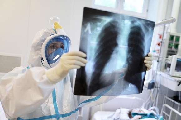 100% уражених легенів. В Дніпрі врятували дуже «важкого» пацієнта