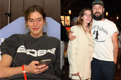 Голливудская звезда пришла на красную дорожку спустя полчаса, как собака укусила ее за лицо