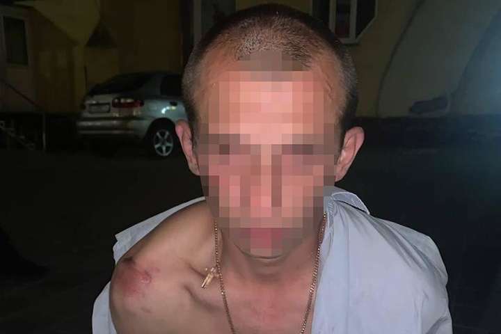 Відібрав сумки і вдарив ножем: у будинку в Києві молодик напав на жінку (фото, відео)