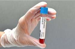 Коронавірус «Дельта». Що важливо знати про симптоми нового штаму