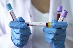 Covid-19 ставатиме смертоноснішим – заява ООН