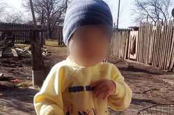 Медики не змогли врятувати малюка