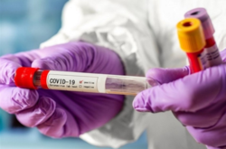 В Украине за сутки выявлено более 700 новых больных на коронавирус