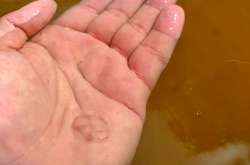 Кияни дедалі частіше зустрічають медуз у Дніпрі. Чим небезпечні екзотичні тварини