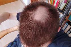 Ужасные стрижки людей, которые решили сыграть в «сам себе парикмахер». Курьезные фото