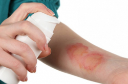 Українські генетики використовують штучні замінники шкіри