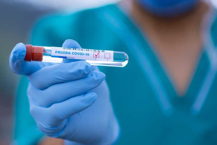 За сутки в Украине обнаружили почти 700 новых случаев коронавируса