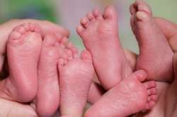 В Ужгороді народилася трійня, яку рятували за допомогою унікальної лікарської методики