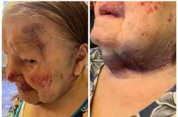 Побита жінка спочатку не стала&nbsp;розповідати про це своїм родичам