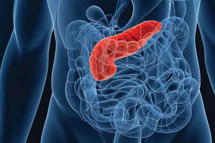 Вчені назвали симптоми раку підшлункової залози