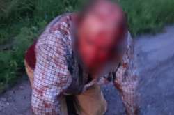 Вдарили ножем та викрали авто: під Києвом скоєно напад на пасічника (фото, відео)