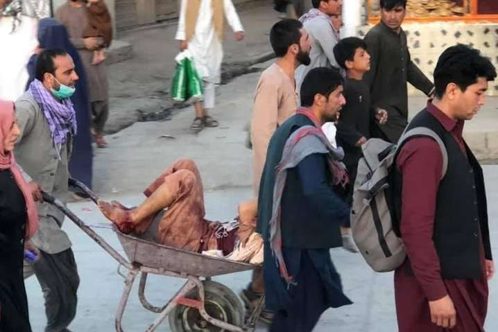 Взрыв в Кабуле: число жертв достигло 13, среди погибших есть дети (фото)
