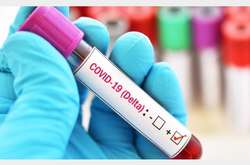 Щоб уберегтися від «Дельти», Ігор Кузін порадив носити маску