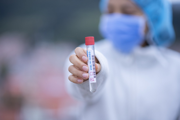 Главный санврач назвал критическим коэффициент обнаружения коронавируса в Украине