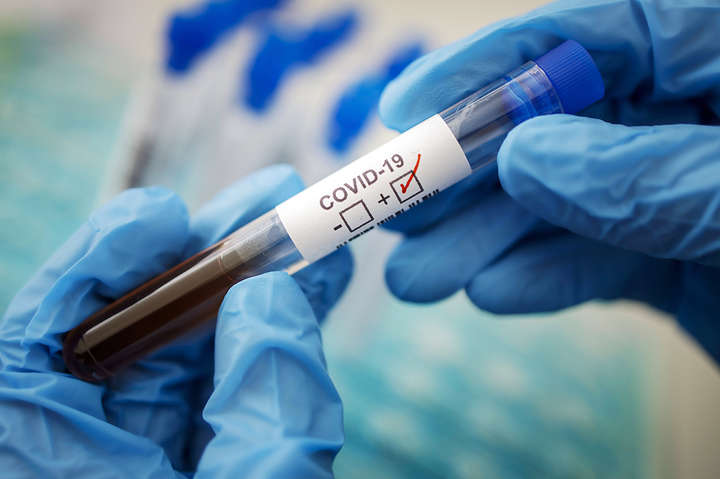 Головний санлікар назвав критичним коефіцієнт виявлення коронавірусу в Україні