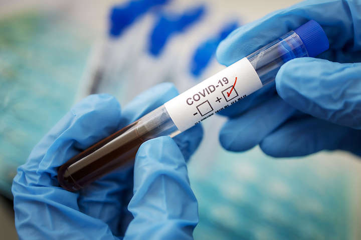 Вчені з'ясували причину важкого перебігу коронавірусної хвороби
